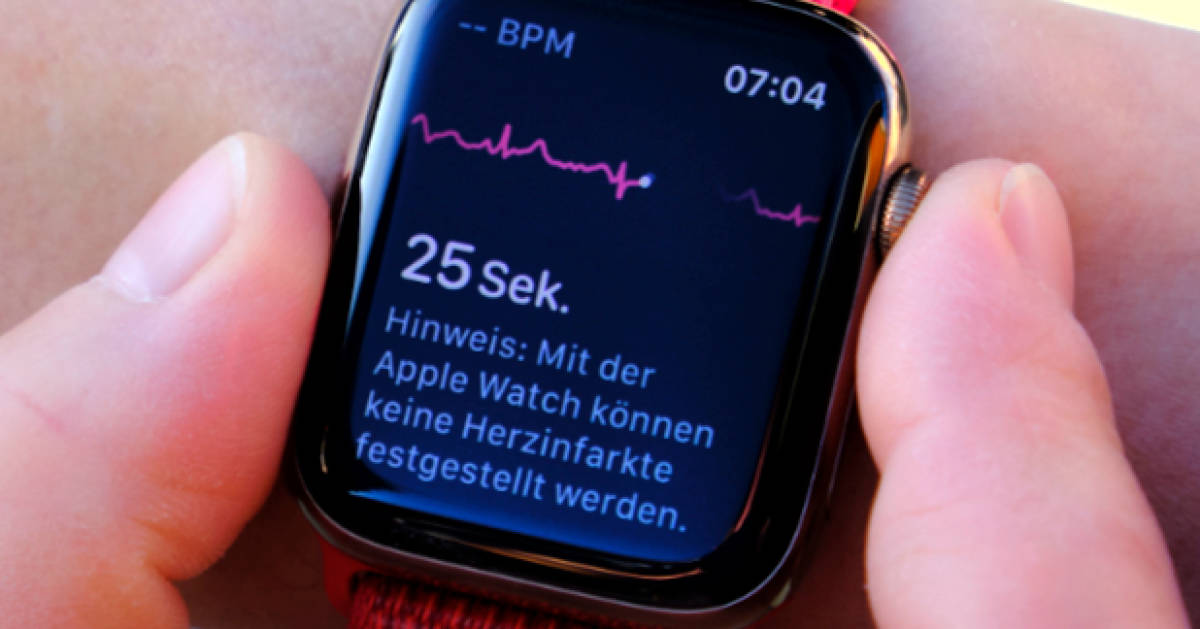 ekg app iwatch