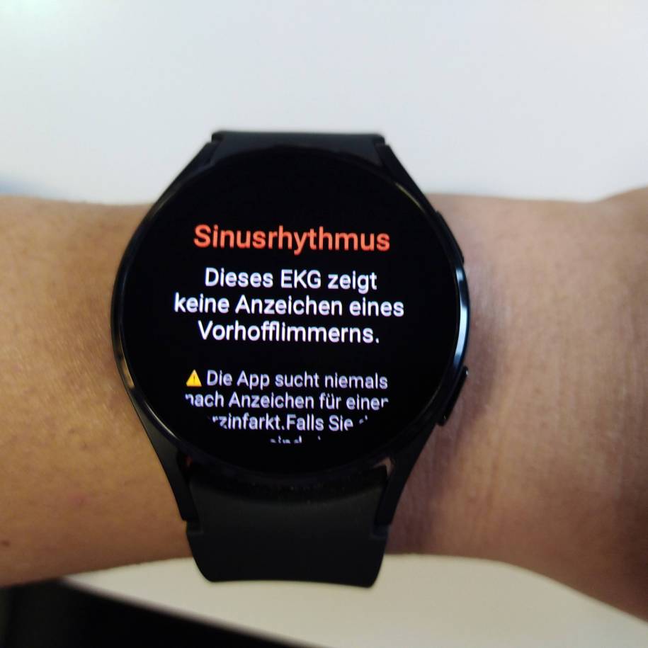 Samsung galaxy watch ekg online
