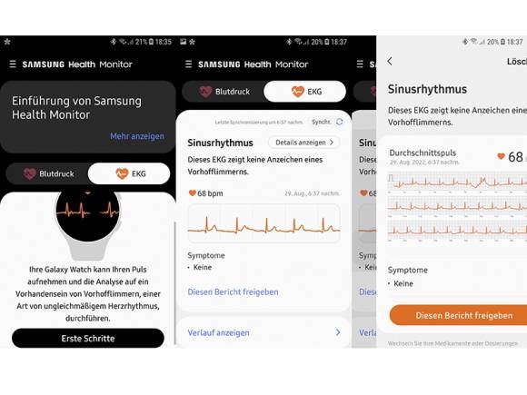 Screenshots der EKG-Messresultate